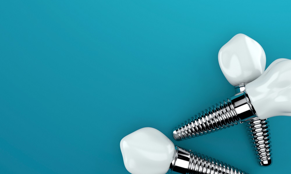 Implanty zębowe. Komu i kiedy są dedykowane? - zdjęcie na Stomatologia Skrzat
