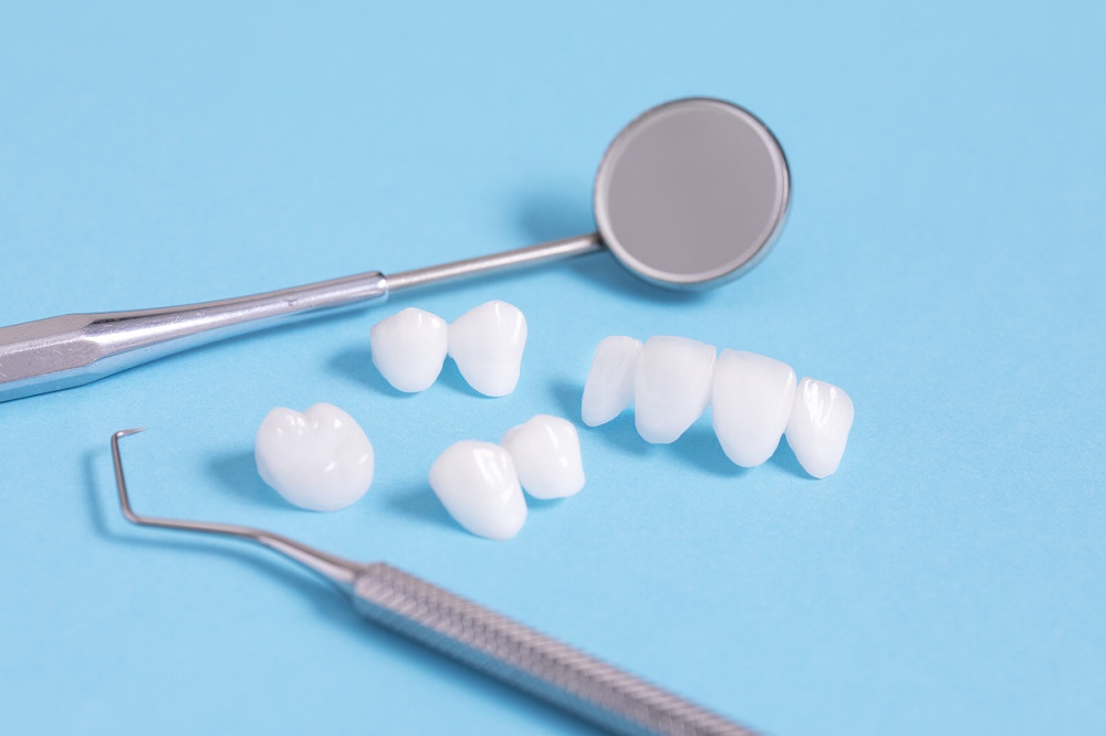 Różnice między koroną pełnoceramiczną a koroną porcelanową - zdjęcie na Stomatologia Skrzat
